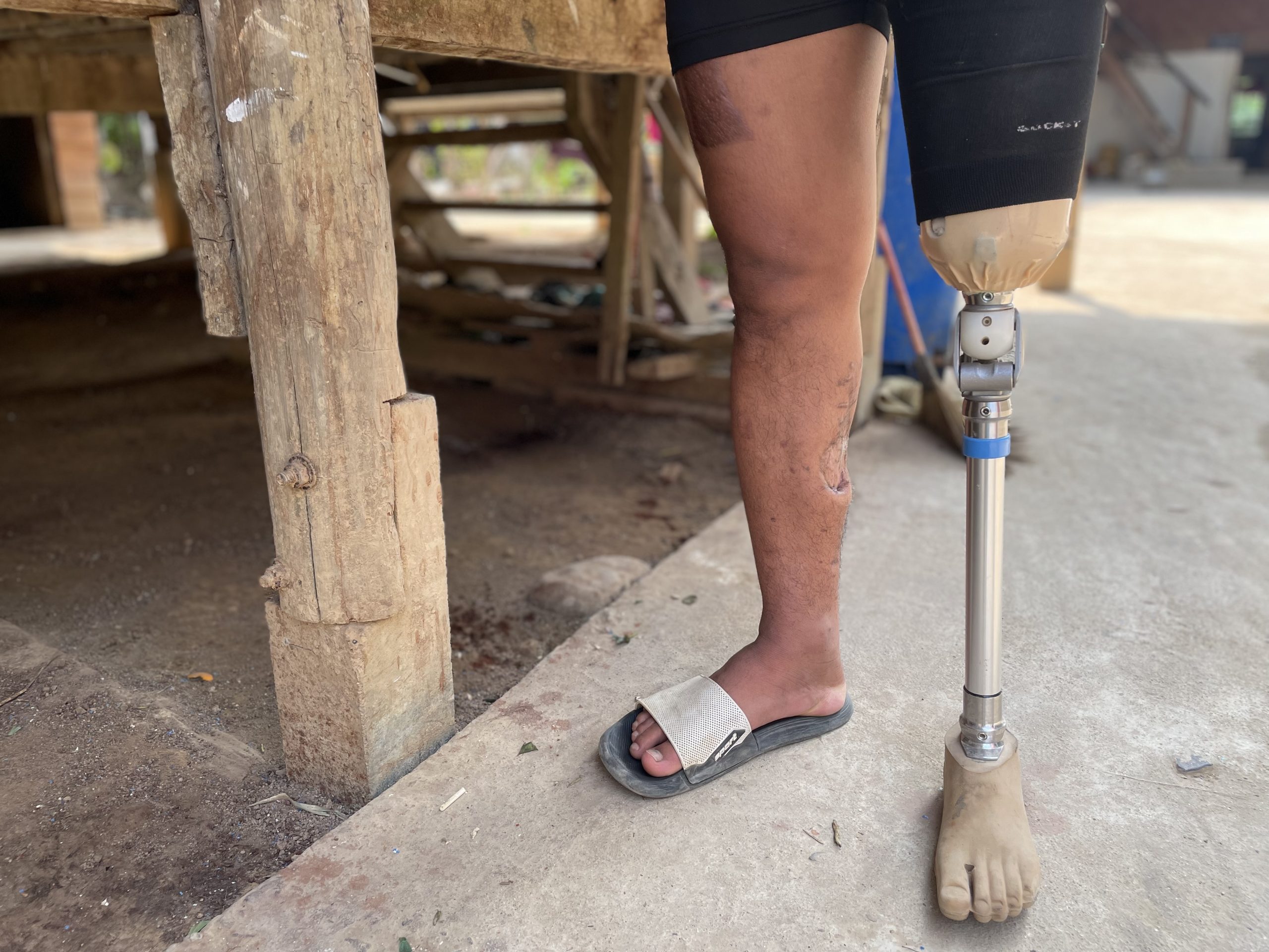 Landmine clearance project